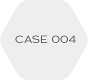 CASE 004